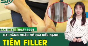 Bản Tin Y Tế 10/3: Tiêm filler để làm thẳng chân, cô gái 29 tuổi biến dạng cẳng chân