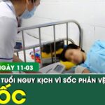 Bản tin Y tế 11/3: Mổ lấy thai khẩn cấp cho thai phụ 25 tuổi nguy kịch sau khi ăn ốc