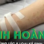 Người phụ nữ nhiễm cùng lúc 5 loại ký sinh trùng