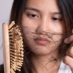 Sự thật về rụng tóc khi dùng biện pháp tránh thai nội tiết tố