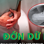 Người đàn ông đau đớn dữ dội, cấp cứu vì chai nhựa dài kẹt trong trực tràng suốt 2 ngày