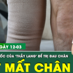 Bản Tin Y Tế 12/3: Suýt mất chân sau khi đến ‘thầy lang’ bó thuốc