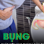 Thường xuyên đầy bụng, nam thanh niên bàng hoàng phát hiện ung thư dạ dày giai đoạn cuối