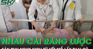 Cứu sản phụ và thai nhi khỏi nguy kịch do nhau cài răng lược trên vết mổ lấy thai cũ