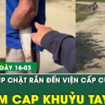 Bản Tin Y Tế 16/3: Cụ ông 79 tuổi đi cấp cứu với con rắn 2m cắn chặt vào khuỷu tay