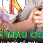 Hút 2 bao thuốc mỗi ngày, người đàn ông nhồi máu cơ tim sốc tim nguy kịch trong đêm