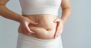 Vì sao người gầy vẫn có nhiều mỡ bụng?