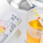 Làm thế nào để nhận biết trẻ bị rối loạn đi tiểu?