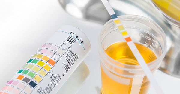 Làm thế nào để nhận biết trẻ bị rối loạn đi tiểu?