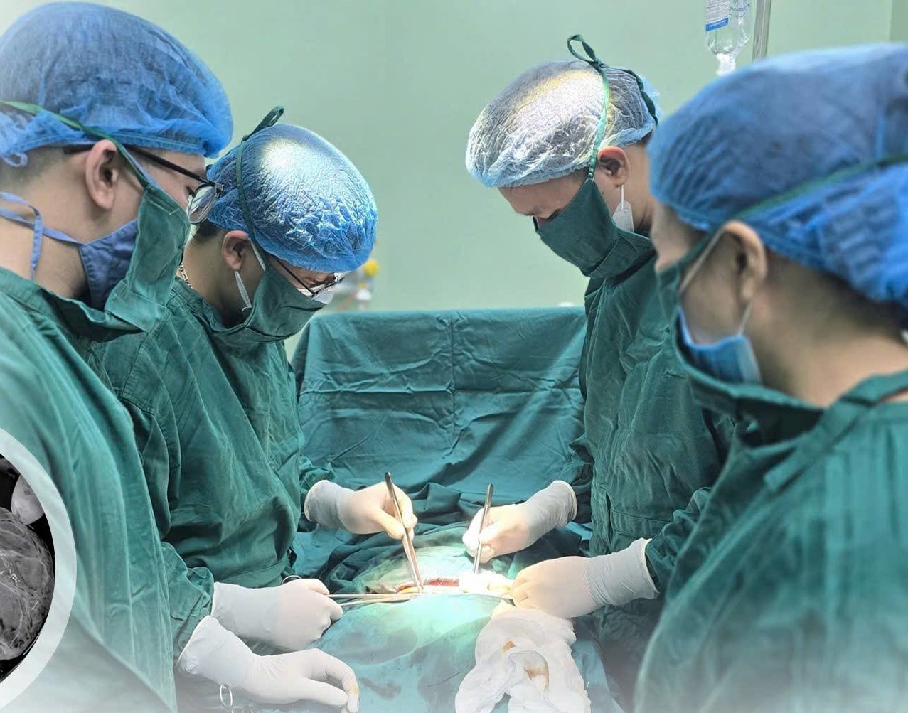 Cấp cứu kịp thời ca rau bong non, mẹ tròn con vuông- Ảnh 1.