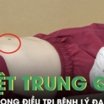 Hướng dẫn cách bấm huyệt trung quản hỗ trợ giảm đau dạ dày