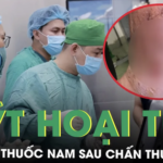 Tự bó thuốc nam sau chấn thương, người đàn ông viêm mô bào suýt hoại tử