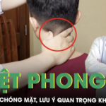 Hướng dẫn cách bấm huyệt phong trì trị hoa mắt chóng mặt