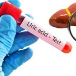 Cách dùng cần tây hỗ trợ giảm axit uric tại nhà: Lợi ích và những điều cần lưu ý