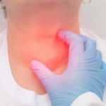 Tuyến giáp lệch một nhịp, nội tiết của chị em cũng rối loạn theo