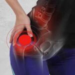 Viêm khớp háng, nhận biết sớm giúp ngăn ngừa hệ lụy