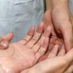 Giải pháp hỗ trợ điều trị giảm đổ mồ hôi tay hiệu quả