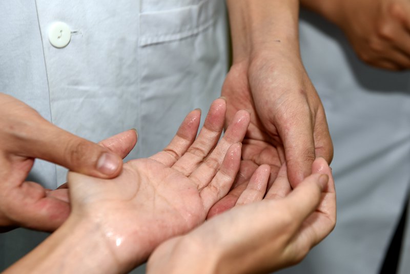 Giải pháp hỗ trợ điều trị giảm đổ mồ hôi tay hiệu quả- Ảnh 2.