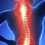 Dùng thuốc trị giảm đau thoái hóa cột sống ở người cao tuổi