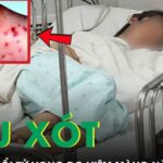 Đau xót: Bé gái 11 tuổi tử vong do viêm màng não mô cầu thể tối cấp