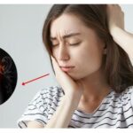 Dinh dưỡng hỗ trợ phòng ngừa biến chứng của viêm khớp thái dương hàm