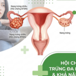 4 cách cải thiện khả năng sinh sản ở phụ nữ mắc Hội chứng buồng trứng đa nang