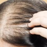 5 thói quen gây hại khiến tóc ngày càng mỏng đi