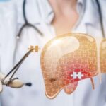 Yếu tố nguy cơ làm tăng tỷ lệ mắc ung thư gan