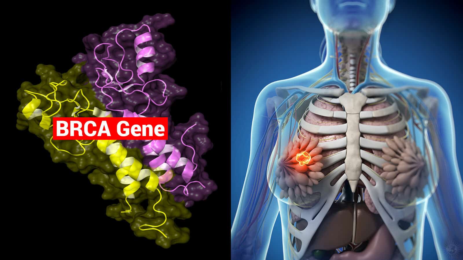 Mẹ mắc ung thư vú, con gái có bị không?- Ảnh 1.
