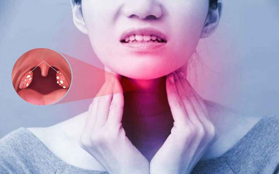 Viêm amidan tái phát có nên cắt không?