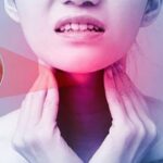 Tại sao viêm họng hạt dễ tái phát?