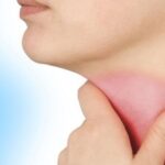 Viêm thanh quản có dẫn đến ung thư không?