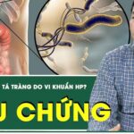 [LIVE] Triệu chứng viêm loét dạ dày, tá tràng do vi khuẩn HP