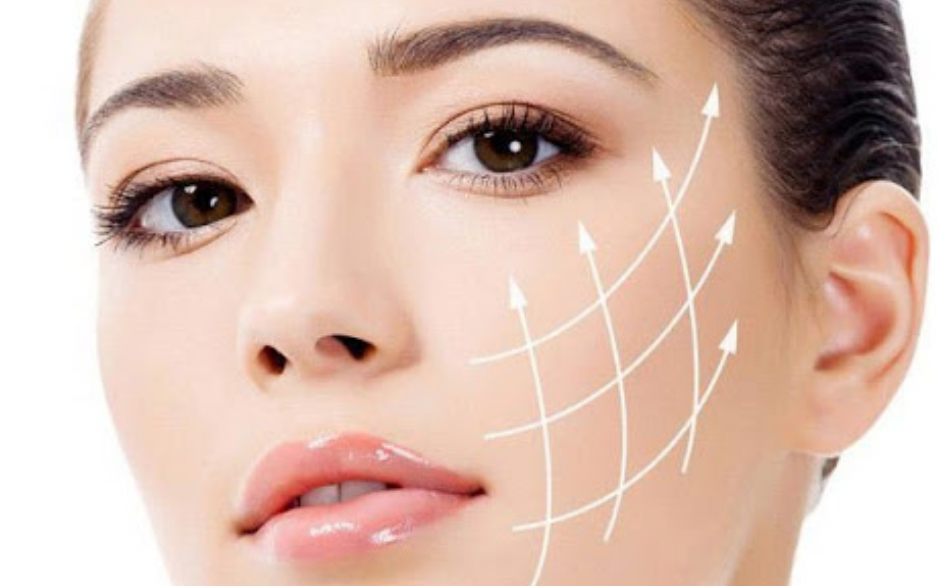Ai không nên căng da mặt bằng chỉ?