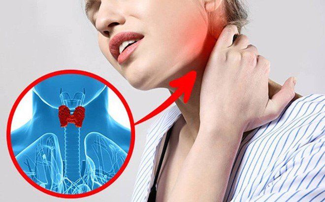 Tê tay ban đêm có nguy hiểm không, khắc phục như  thế nào?- Ảnh 2.