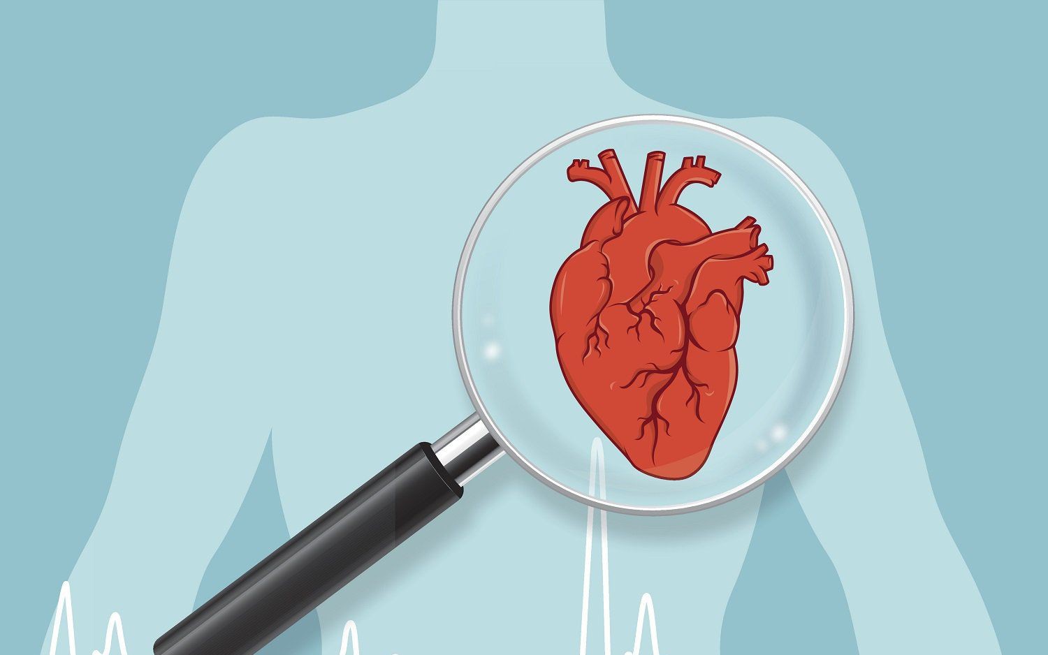 Vì sao bệnh nhân đái tháo đường type 2 cần dùng statin thường xuyên?- Ảnh 3. 5 nguyên tắc phòng ngừa biến chứng tim mạch ở người bệnh đái tháo đường