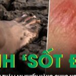 Bệnh ‘sốt đất’ bùng phát tại Thái Lan khiến hàng chục người tử vong