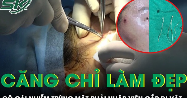 Căng chỉ làm đẹp tại spa cô gái trẻ nhiễm trùng mặt phải nhập viện gắp dị vật