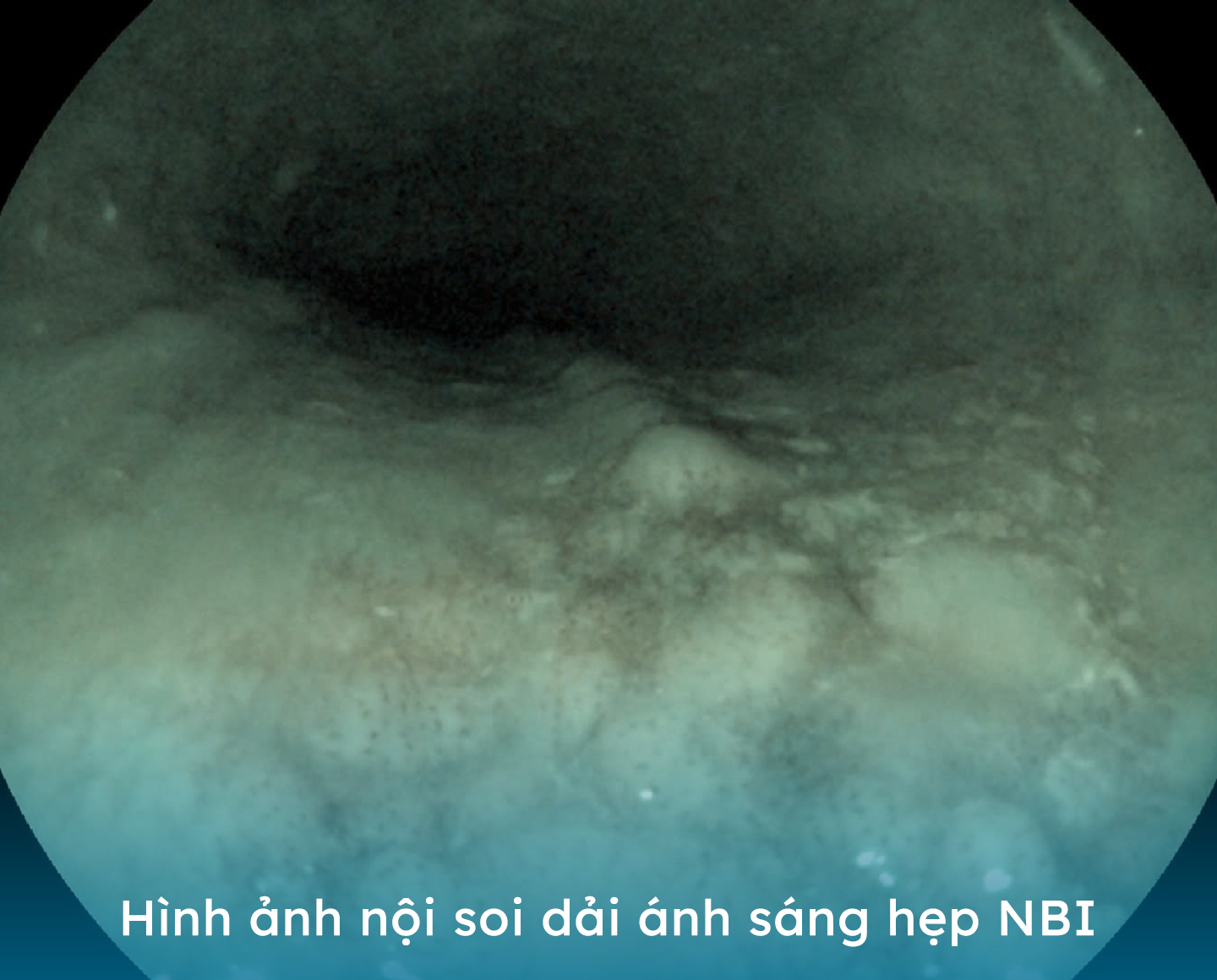 Bệnh viện Hoàn Mỹ Vinh: phát hiện nhiều trường hợp tiền ung thư thông qua nội soi- Ảnh 2. Bệnh viện Hoàn Mỹ Vinh: phát hiện nhiều trường hợp tiền ung thư thông qua nội soi- Ảnh 2.