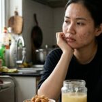 Ăn mỡ lợn có gây nổi mụn trứng cá không?