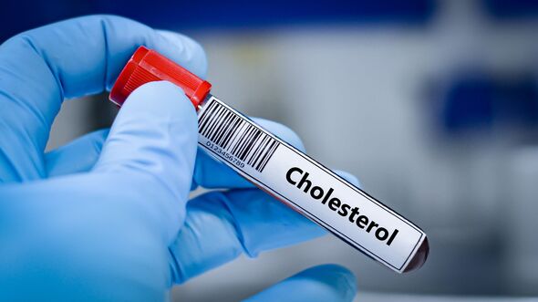 5 biện pháp không dùng thuốc kiểm soát cholesterol cao hiệu quả- Ảnh 1. 5 biện pháp không dùng thuốc kiểm soát cholesterol cao hiệu quả- Ảnh 1.