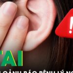 Ù tai có thể là dấu hiệu cảnh báo bệnh nguy hiểm