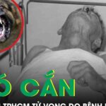 Chó cắn, 3 người tại TPHCM tử vong do bệnh dại