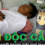 Tiêm 30 lọ huyết thanh cứu người chủ bị rắn độc cắn