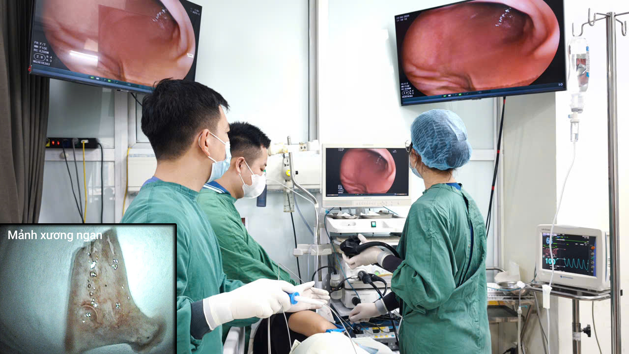 Người đàn ông cấp cứu sau bữa ngan luộc- Ảnh 3. Người đàn ông cấp cứu sau bữa ngan luộc- Ảnh 3.