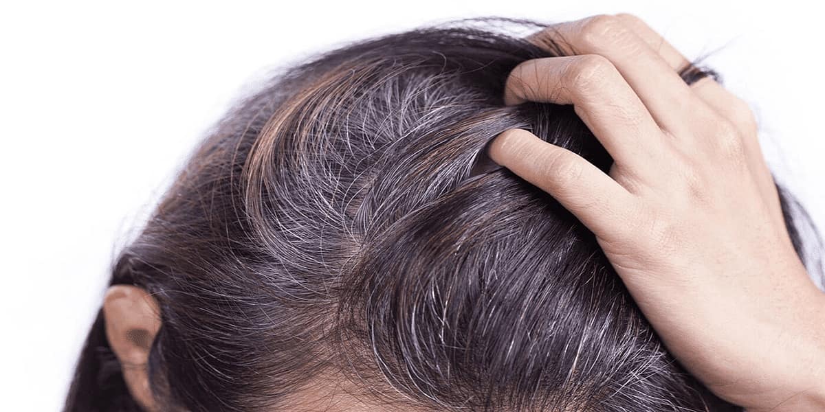 Bí quyết ngăn ngừa tóc bạc sớm từ quả dâu tằm- Ảnh 1. Bí quyết ngăn ngừa tóc bạc sớm từ quả dâu tằm- Ảnh 1.