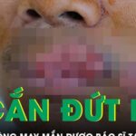 Người đàn ông bị cắn mất môi phải trải qua ca tạo hình phức tạp