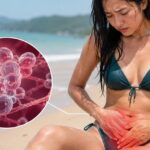 Sai lầm khi đi biển khiến viêm âm đạo do nấm tái phát nhiều lần