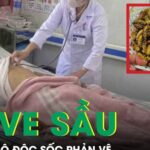 Ăn ve sầu, 9 người bị ngộ độc sốc phản vệ