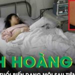Thiếu nữ 18 tuổi biến dạng môi sau tiêm tan filler tại cơ sở thẩm mỹ chui